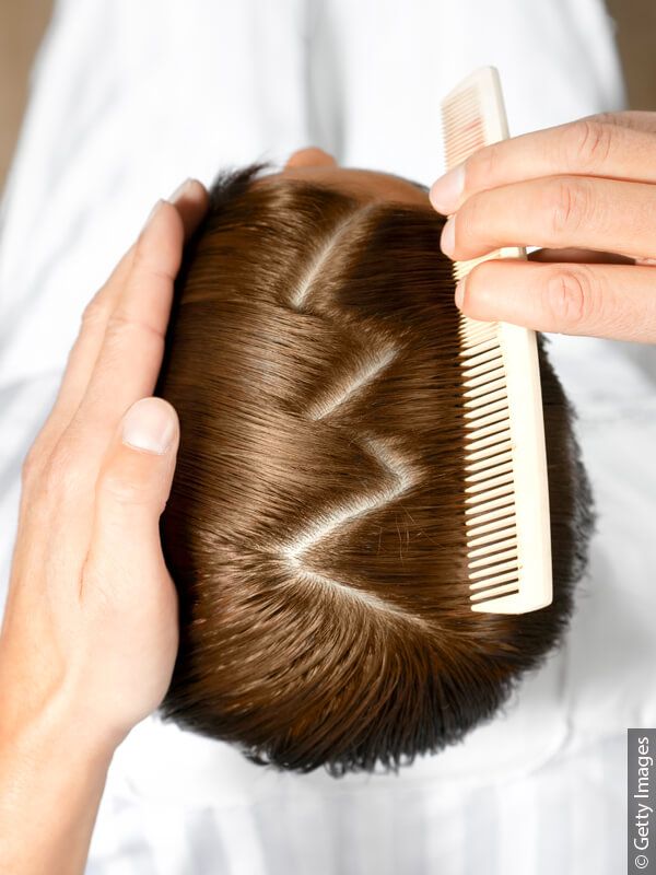 Top view of a head and hands creating a zigzag part with a comb