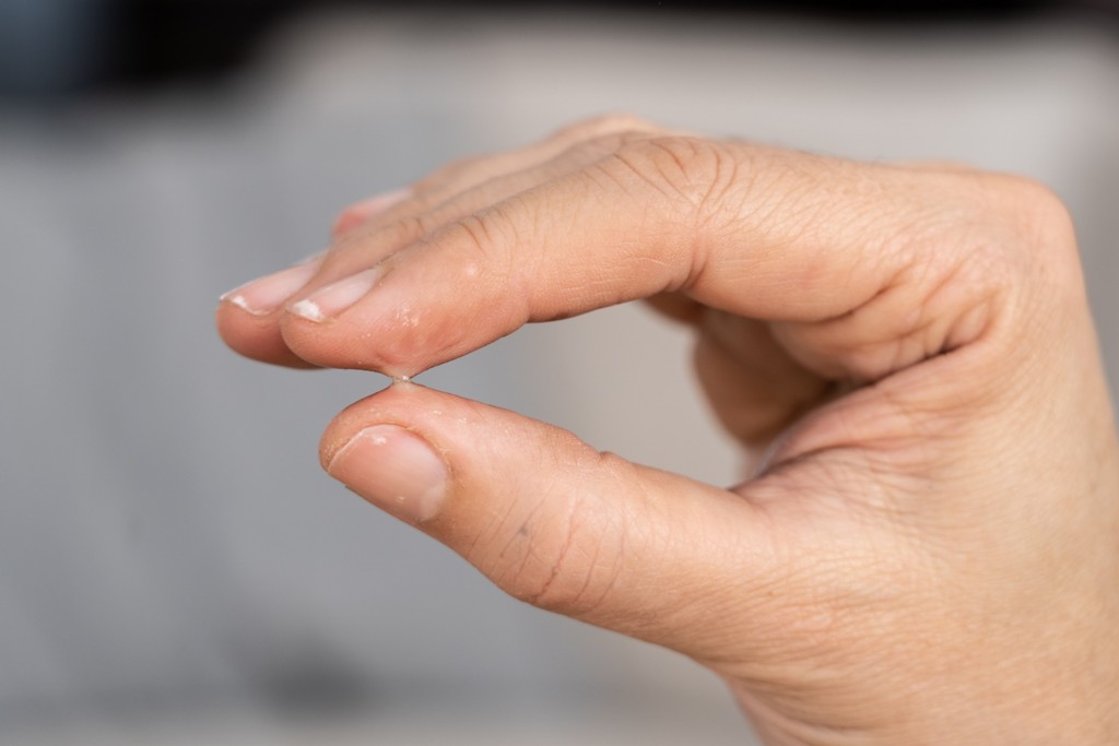 Cómo quitar super glue de la piel el cabello