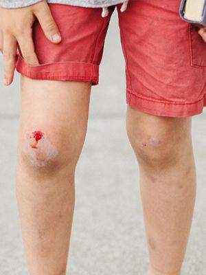 Шәует дақтарын матадан кетіру